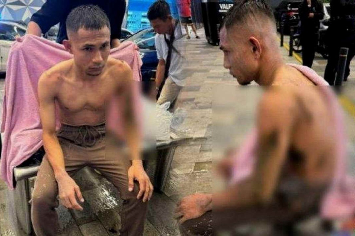 Pemain Timnas Malaysia, Faisal Halim Disiram Air Keras, Siapa Pelakunya?