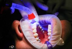 Dimana Alamat Klinik Djoshy Dental Care? Tempat Nira Pranita Asih Cabut Gigi Hingga Meninggal Dunia Ternyat yang Mengoperasi Dokter Umum Bukan Spesialis Bedah Mulut