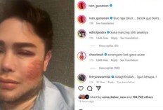 Profil dan Biodata Ivan Gunawan: Lengkap Dengan Agama, Akun IG Hingga Orang Tua, Viral Karena Bagikan Potret Muka Lebam, Ada Apa?